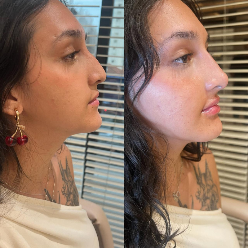 Resultado antes e depois — caso 3