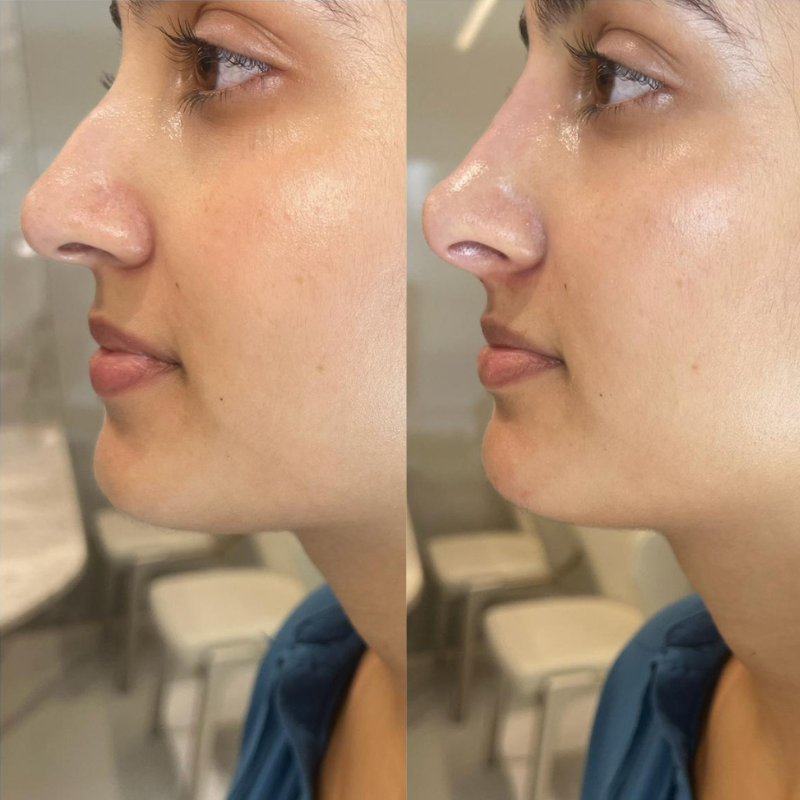 Resultado antes e depois — caso 6