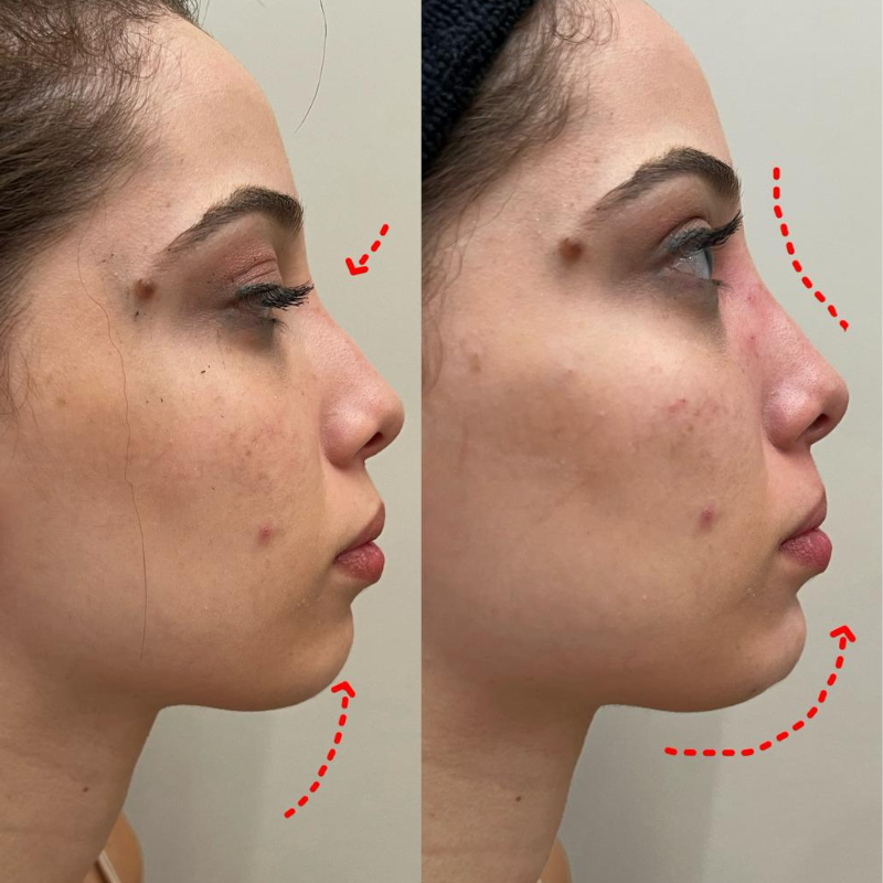 Resultado antes e depois — caso 7