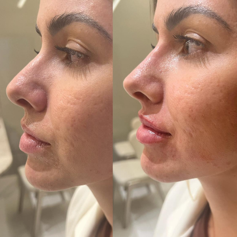 Resultado antes e depois — caso 8